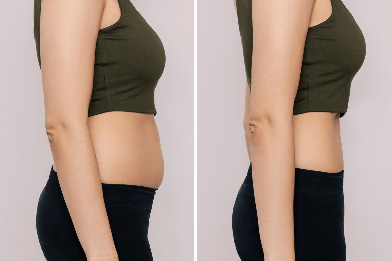 Benefits of weight loss therapy with semaglutide
