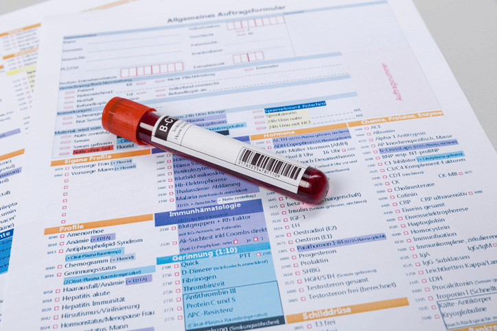 Blood tests for low testosterone