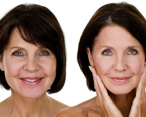 How Does Growth Hormone Therapy Make You Look and Feel Younger