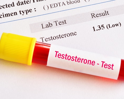 How Is Low Testosterone Diagnosed