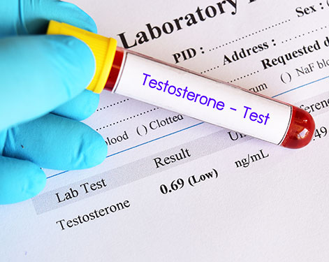 Testosterone Levels 
