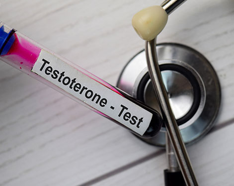 Testosterone Deficiency