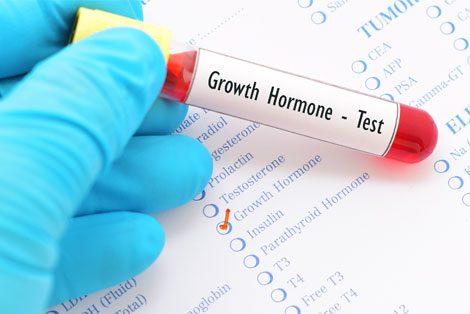 Human Growth Hormone Testing