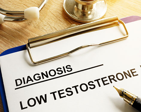 Low Testosterone Levels