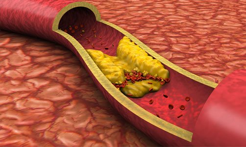 Lower Cholesterol and Triglyceride Levels