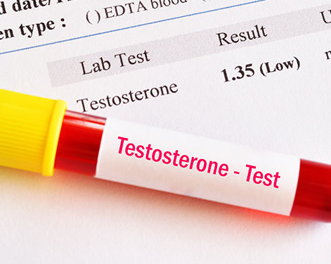 Testosterone